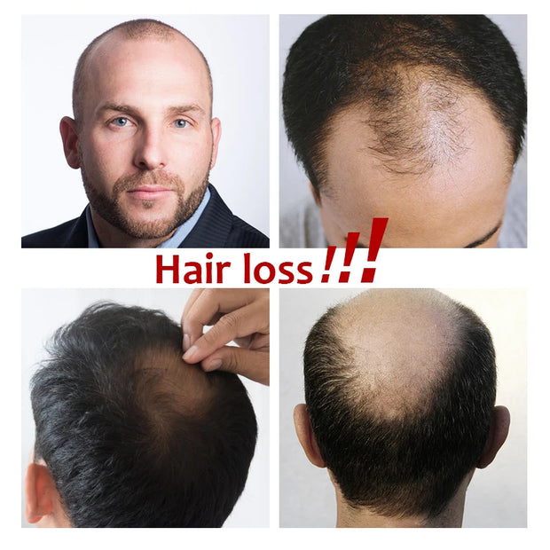Male Straight Men Toupee Silk PU Base Natural Human Hair Wig Men's Capillary Prosthesis 100% Human Hair Systems Breathable Wigs